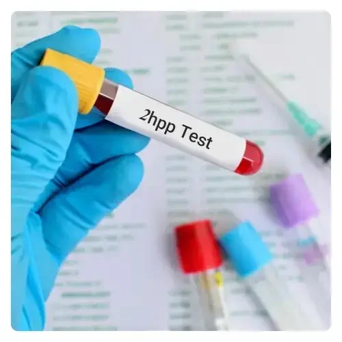 آزمایش-2hpp