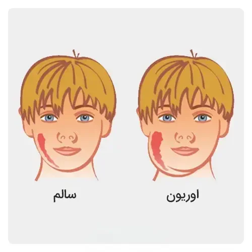 علائم-اوریون