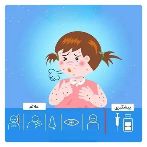 علایم-سرخک